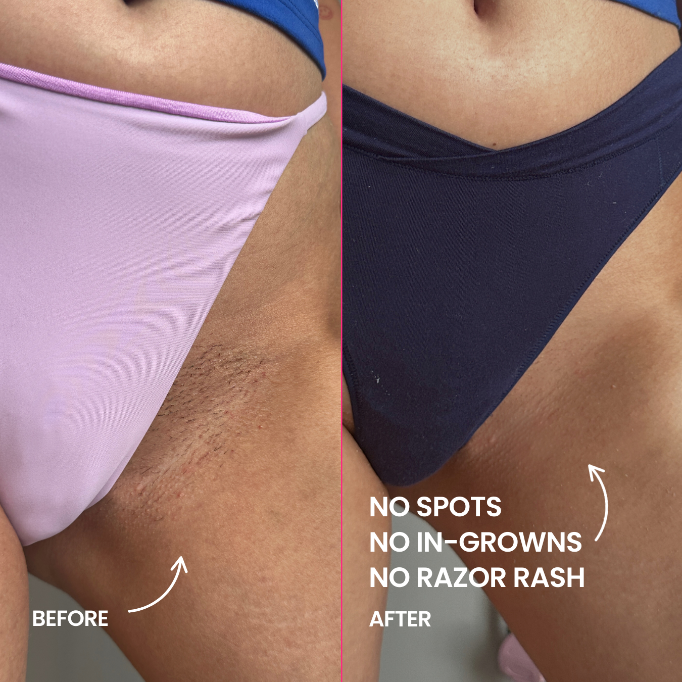 WooWoo Tame It! Vegan In-Shower Hair Removal Cream